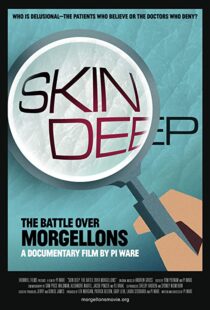 دانلود مستند Skin Deep: The Battle Over Morgellons 2019104233-967669722